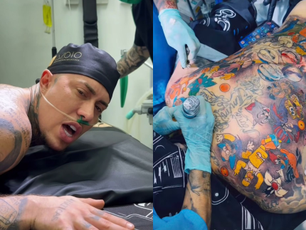 CFM proíbe o uso de anestesia geral e sedação para realização de tatuagem