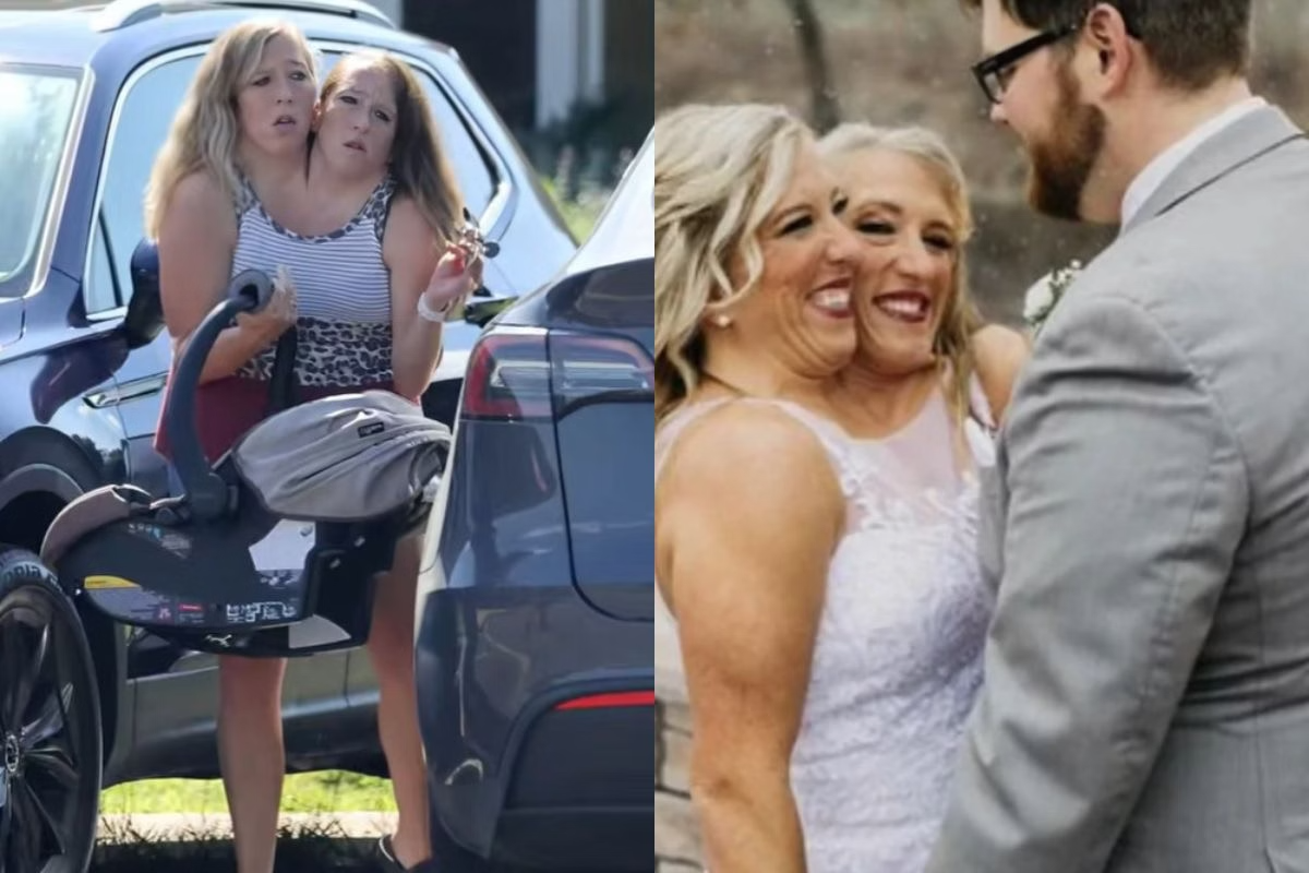 👶💞 Gêmeas Siamesas Compartilham Registros com Bebê: “Abençoada” e Debate Reacende