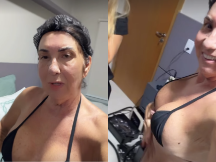 Mãe de Virginia Fonseca exibe resultados de cirurgias após um mês e realiza novo procedimento