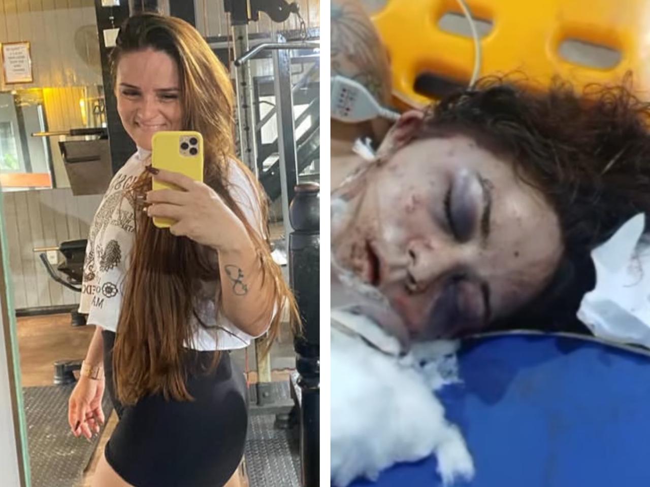 Mulher agredida com cem socos pelo companheiro permanece em estado grave no Pará