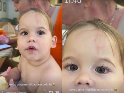 Filho de Virginia Fonseca sofre mordida na escola; influenciadora mostra marca