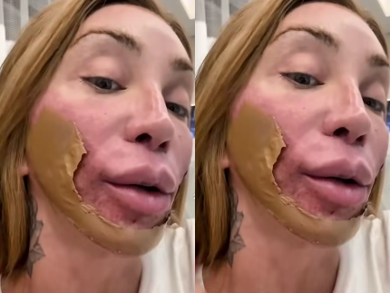 Maya Massafera realiza tratamento estético que promove renovação profunda da pele