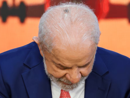 Lula realiza consulta de acompanhamento após remoção de lesão na cabeça