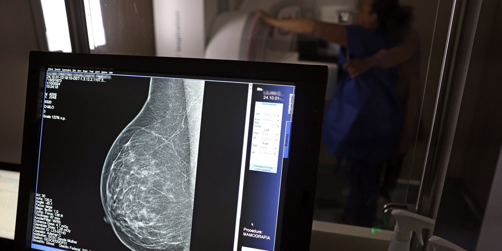 Guia de médicos combate a recusa de mamografia digital por operadoras