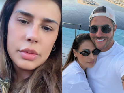 Simone Mendes rebate críticas ao novo nariz e revela reação de Kaká Diniz
