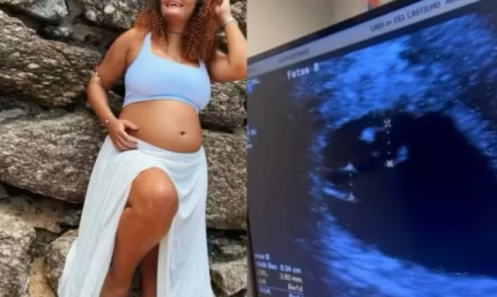 Em dose tripla! Mulher engravida de 3º bebê durante gestação de gêmeos no RJ