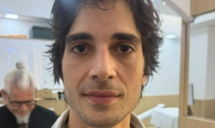 Fiuk surpreende com novo visual após harmonização facial; Veja o antes e depois!