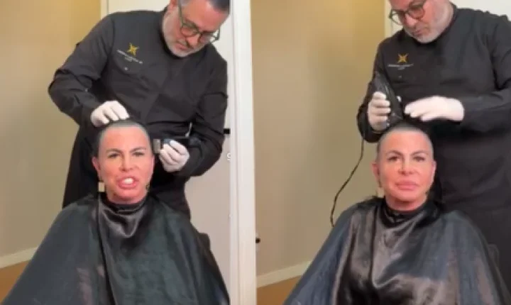 Gretchen raspa a cabeça em transmissão ao vivo antes de passar por transplante capilar