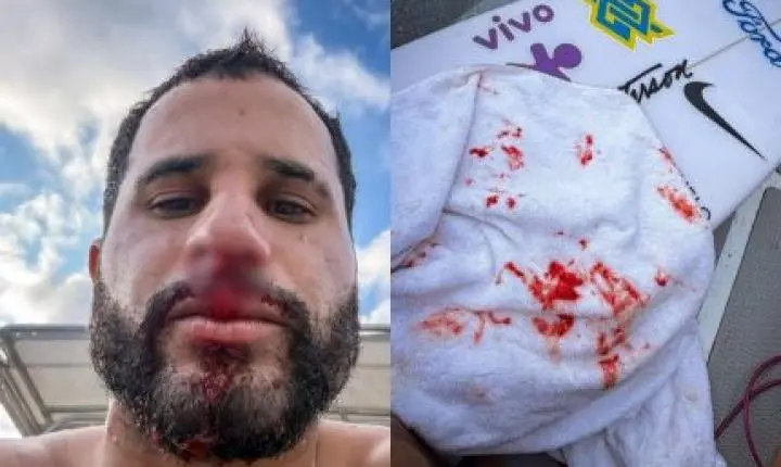 Ítalo Ferreira sofre acidente em treino e leva pontos no nariz: “Dor que não desejo pra ninguém”