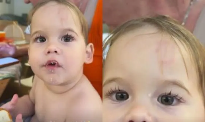 Filho de Virginia Fonseca sofre mordida na escola; influenciadora mostra marca