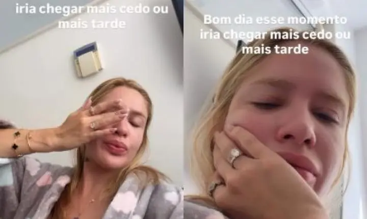 Karoline Lima chama atenção para pele, mas detalhe rouba a cena