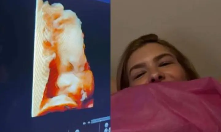 Léo Santana acompanha Lore Improta em ultrassom e brinca sobre semelhança do bebê