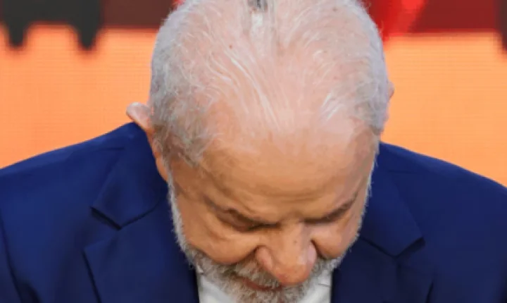 Lula realiza consulta de acompanhamento após remoção de lesão na cabeça