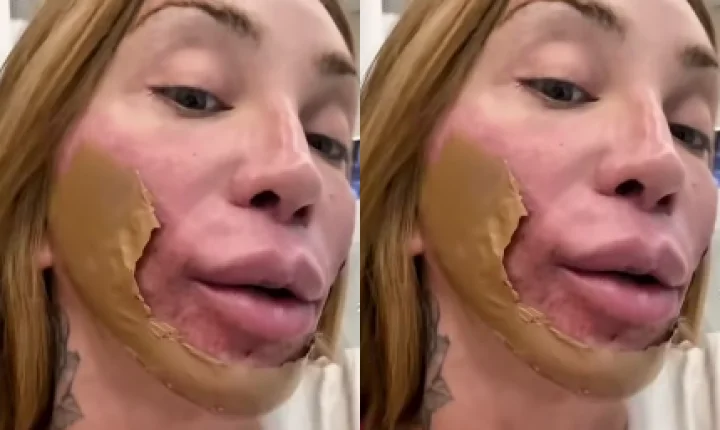 Maya Massafera realiza tratamento estético que promove renovação profunda da pele