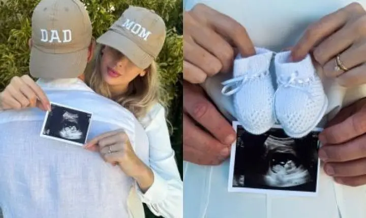Menino ou menina? Amaury Nunes e esposa fazem mistério com ultrassom do bebê