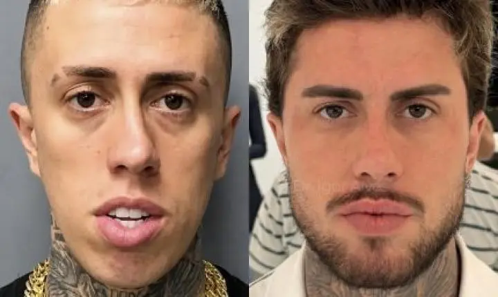 Rennova assina transformação estética de MC e resultado chama atenção nas redes