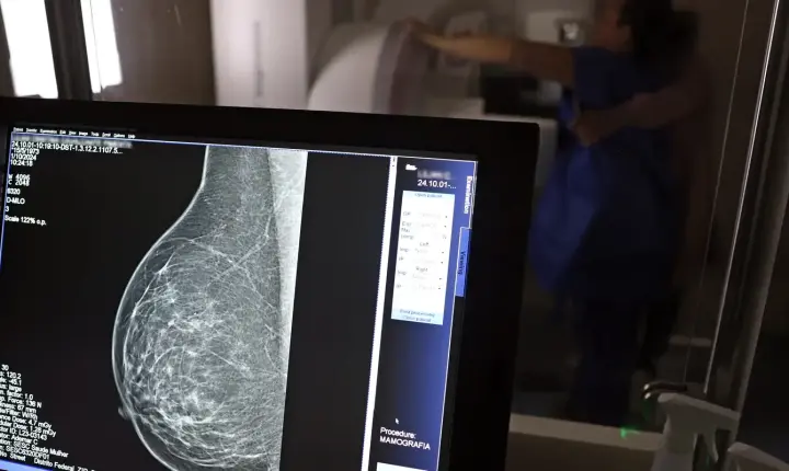 Planos de saúde serão obrigados a cobrir mamografia digital para todas as idades